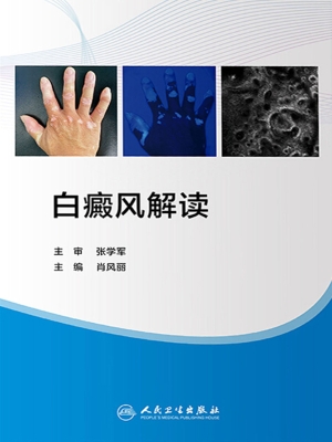 白癜风解读