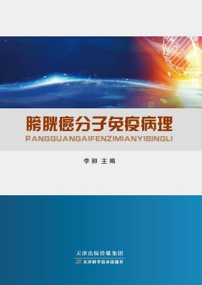 膀胱癌分子免疫病理
