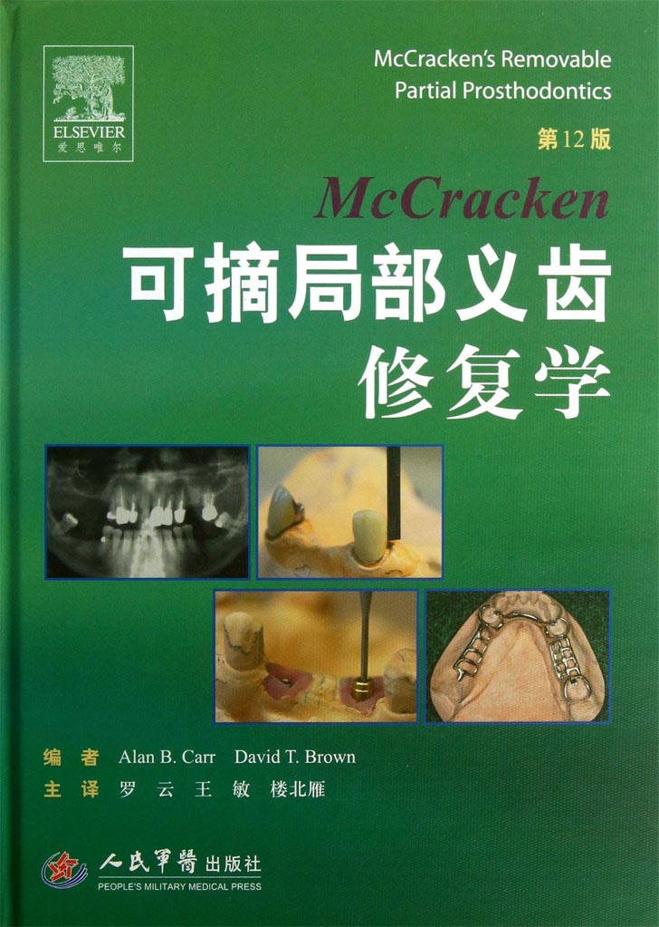 McCracken可摘局部义