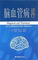 脑血管病诊疗