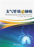 支气管镜与肺癌
