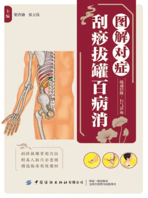 图解对症刮痧拔罐百病