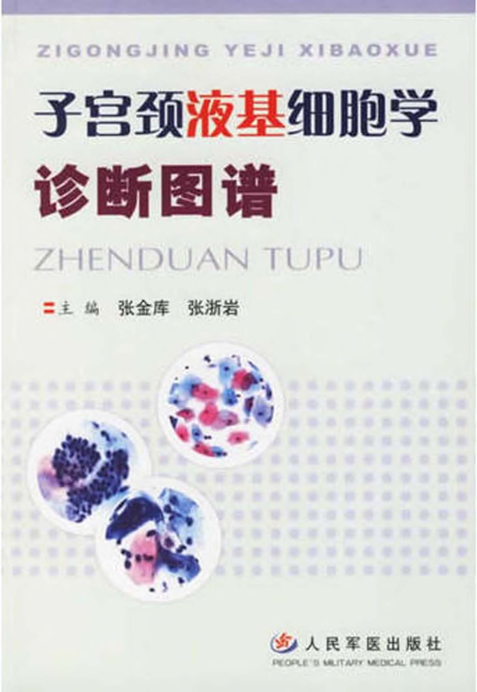 子宫颈液基细胞学诊断