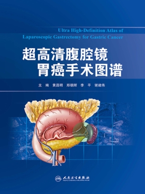 超高清腹腔镜胃癌手术