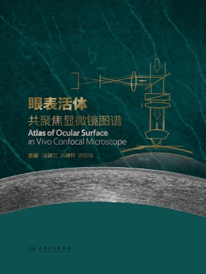眼表活体共聚焦显微镜