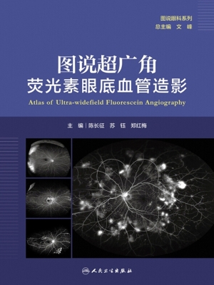 图说超广角荧光素眼底