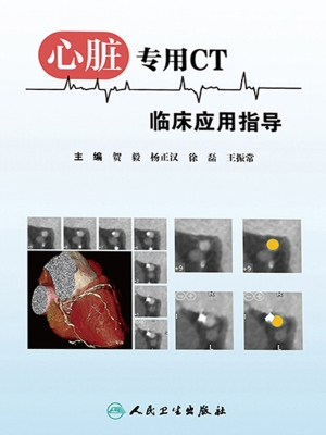 心脏专用CT临床应用指