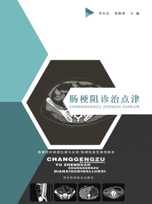 肠梗阻诊治点津
