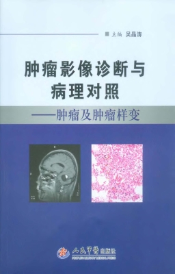 肿瘤影像诊断与病理对