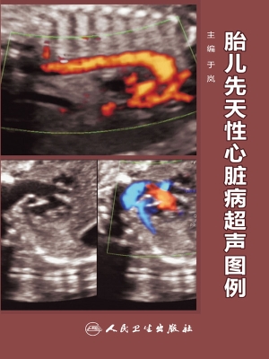 胎儿先天性心脏病超声