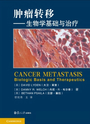 肿瘤转移——生物学基