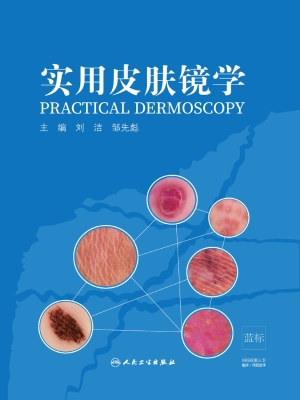 实用皮肤镜学